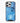 Man City Official 3D Phone Case Design Ruben Dias