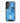 Man City Official 3D Phone Case Design Ruben Dias
